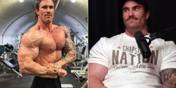 Calum Von Moger Health Scares Coma