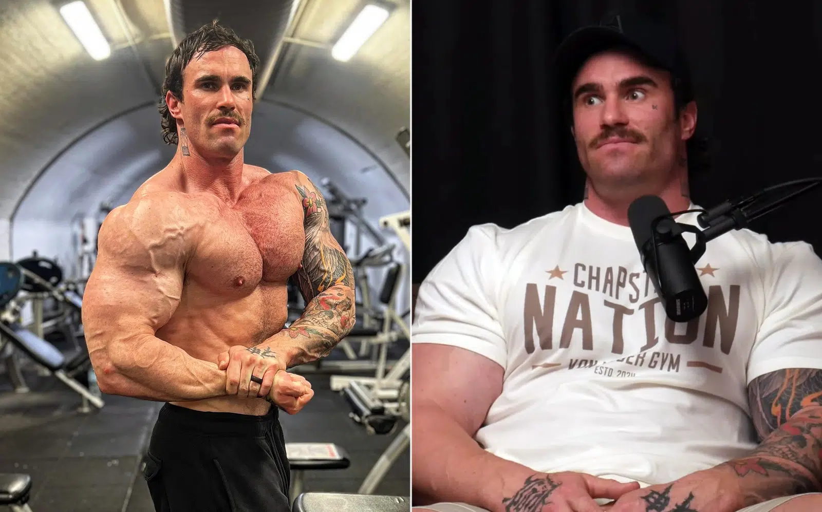 Calum Von Moger Health Scares Coma