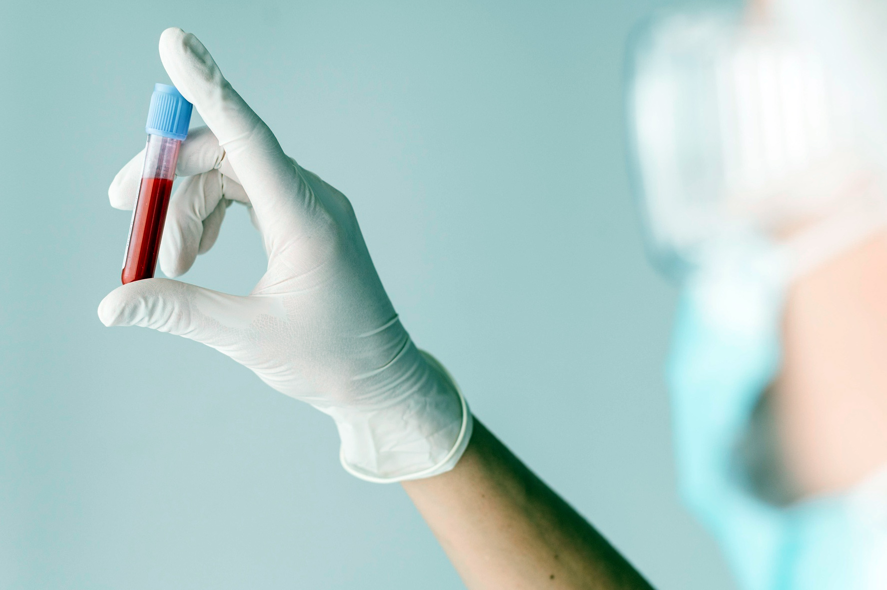 Ultimate Guide on Bloodwork for Bodybuilders: Optimize Muscle Growth