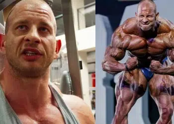 Michal Krizo Talks Upcoming Shoulder Surgery