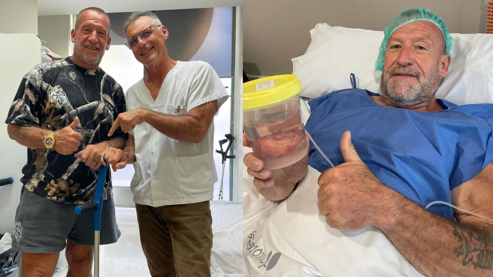 Dorian Yates Gives Health Update 3 Weeks Post Hip Replacement Surgery