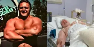 Bill Kazmaier Hospitalized For A Life Threatening Heart Condition