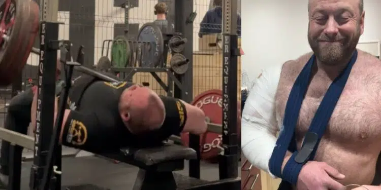Dave Richardson Suffers Arm Fracture During A Heavy Bench Press