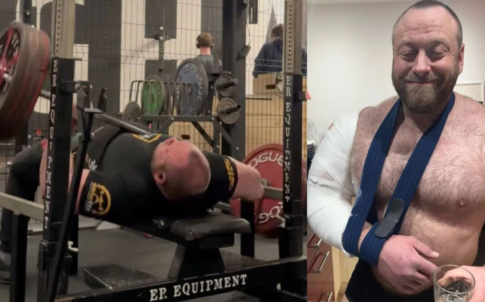 Dave Richardson Suffers Arm Fracture During A Heavy Bench Press