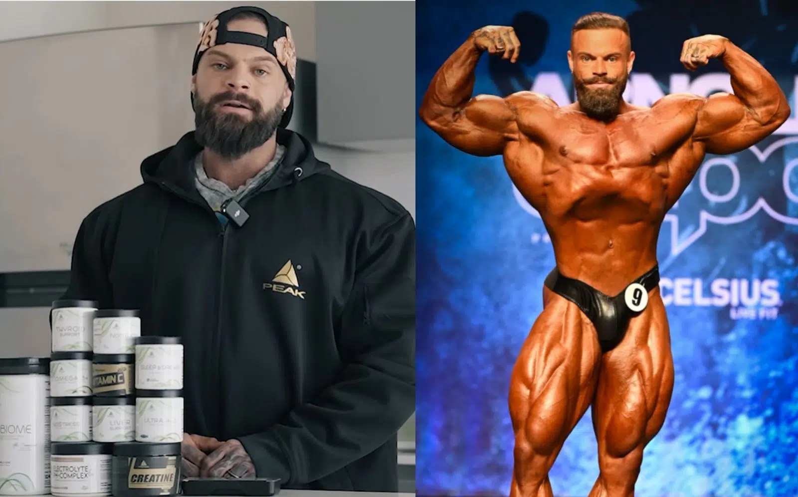 Mike Sommerfeld Reveals His 10 Recovery Supplements