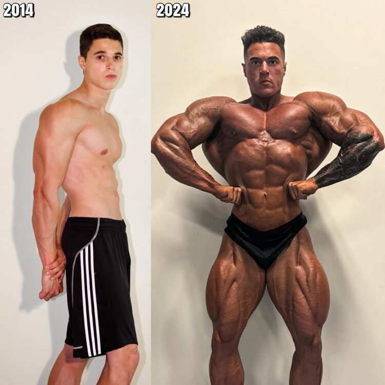 Matt Greggo Transformation