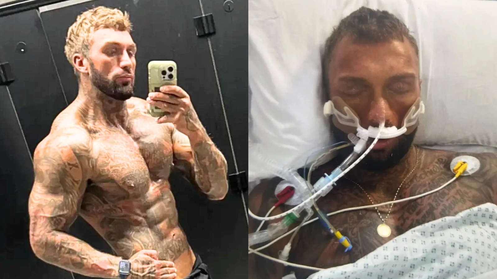Bodybuilder Forced Into Medically Induced Coma After Abusing Steroids for 2+ Years – Fitness Volt