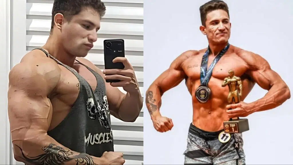 Bodybuilding Champ