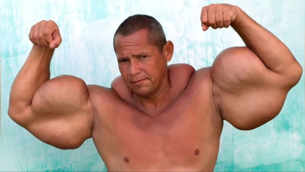 Brazilian Popeye